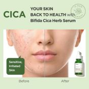 Serum Manyo Bifida Cica Herb Serum Làm Dịu Da 50ML-5
