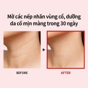 Kem Dưỡng Da Cổ Medi Peel Naite Thread Cao Cấp Chống Lão Hóa 100ML-4