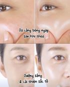 Kem Trị Nám Melatonin Liposome Maxclinic 50g-1