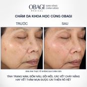 Kem Dưỡng Sáng Da, Mờ Nám Obagi Nu-Derm Clear Fx3  57G-3