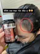 Viên uống Biotin 10,000MG Nutri D-Day Premium giúp kích thích mọc tóc-4