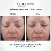 Kem Retinol Obagi Chống Lão Hóa & Tái Tạo Da 28G 1%-4