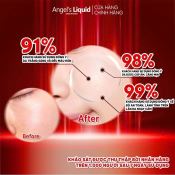 Serum Angel's Liquid  Glutathione 700mg + 5% HA 7Day Whitening Program Dưỡng Trắng Da, Cấp Ẩm Đa Tầng 30ml-5