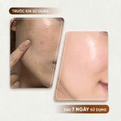 Serum Nám Mommy Care Perilla Whitening Serum Hỗ Trợ Mờ Thâm Nám, Tàn Nhang, Sáng Da 50g-4