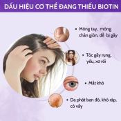 Viên Uống Mọc Tóc Natrol Biotin 10000Mcg Hỗ Trợ Tóc Chắc Khỏe, Giảm Gãy Rụng 100 Viên-5