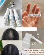 Xịt Mọc Tóc Minoxidil Bailleul Laboratoires Kích Thích Mọc Tóc Và Giảm Rụng Tóc 60Ml 5%-3
