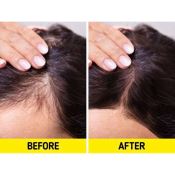 Xịt Mọc Tóc Minoxidil Bailleul Laboratoires Kích Thích Mọc Tóc Và Giảm Rụng Tóc 60Ml 5%-4
